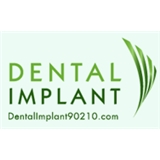 Dental Implant 90210