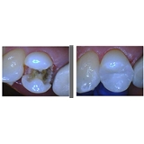 Heights Dental - Ewa Tracz, DDS